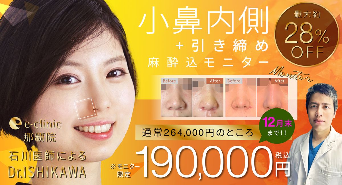 小鼻縮小のバナー