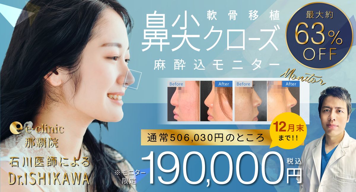 鼻尖形成のバナー