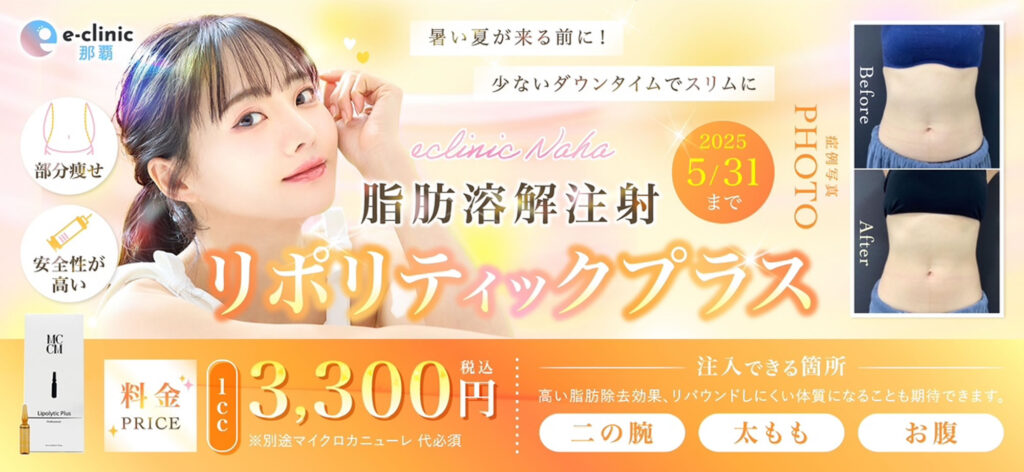 リポリティックプラスのバナー