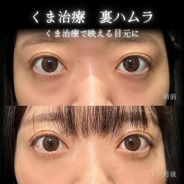 クマ取り 裏ハムラ 那覇