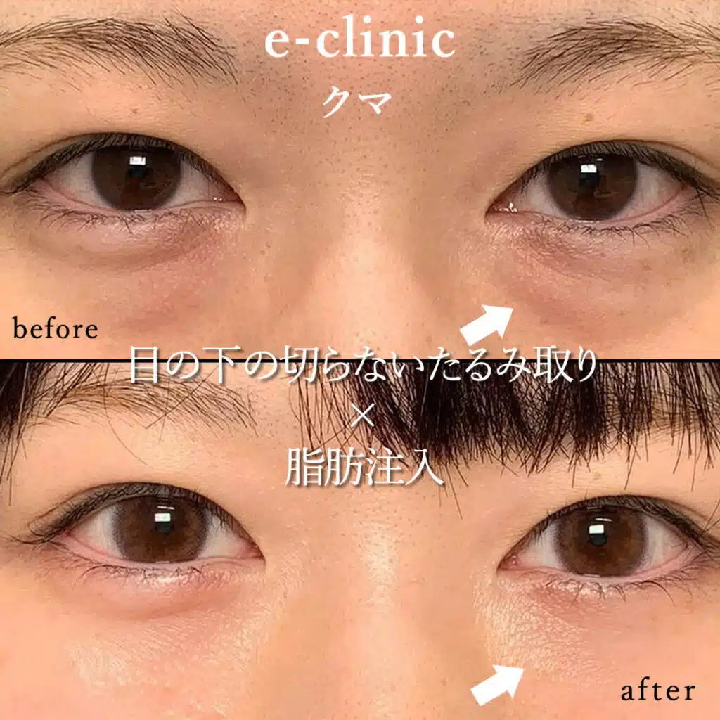 eclinic那覇院の表ハムラの症例画像(1)