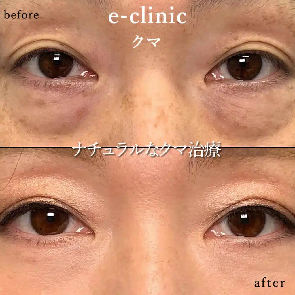 eclinic那覇の表ハムラの症例画像(3)