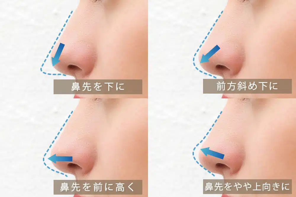 耳軟骨を鼻に挿入するデザイン　那覇