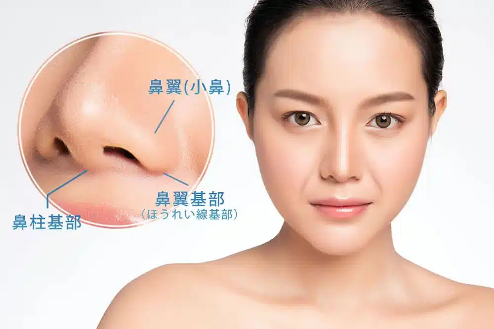 鼻翼基部 那覇