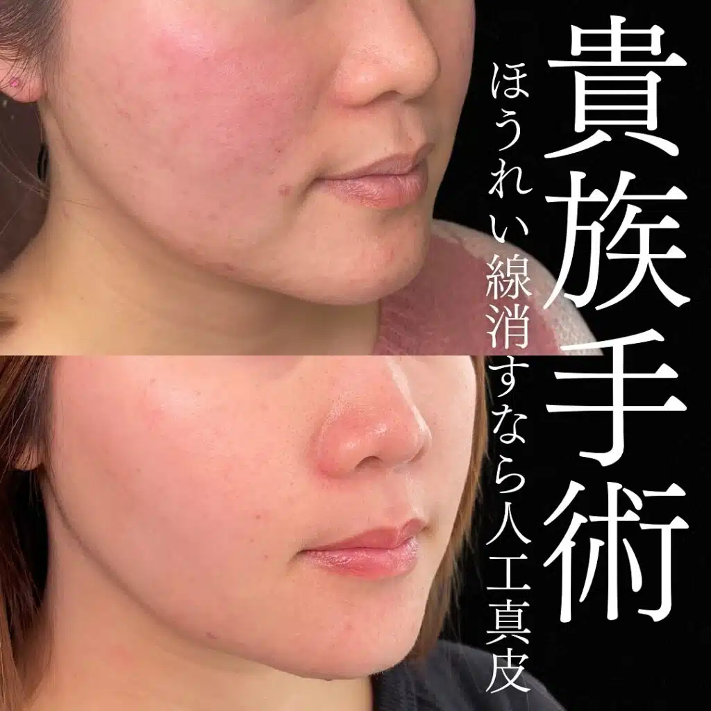 貴族手術 那覇