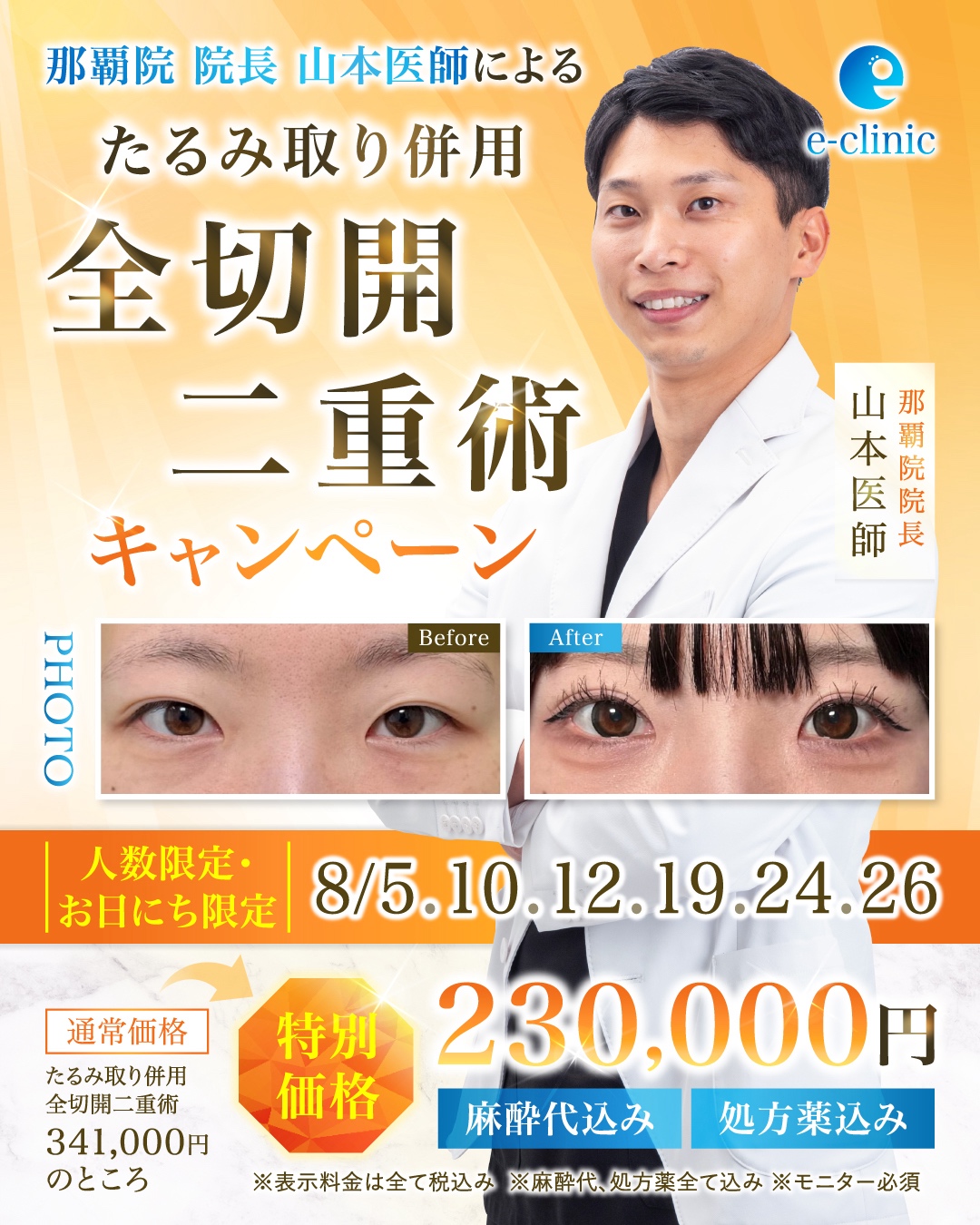 全切開CP