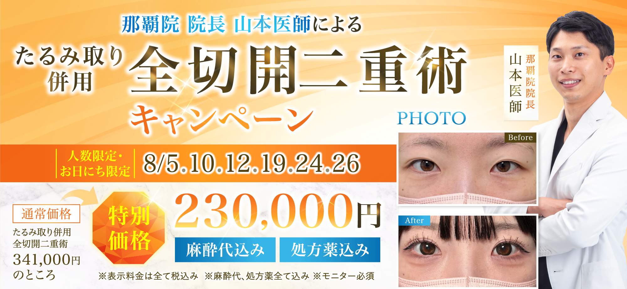 全切開CP