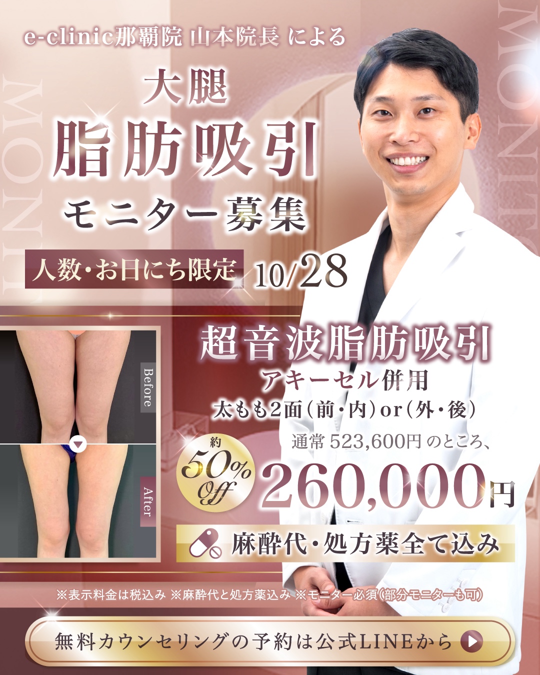 那覇院の太ももの脂肪吸引のキャンペーンバナー