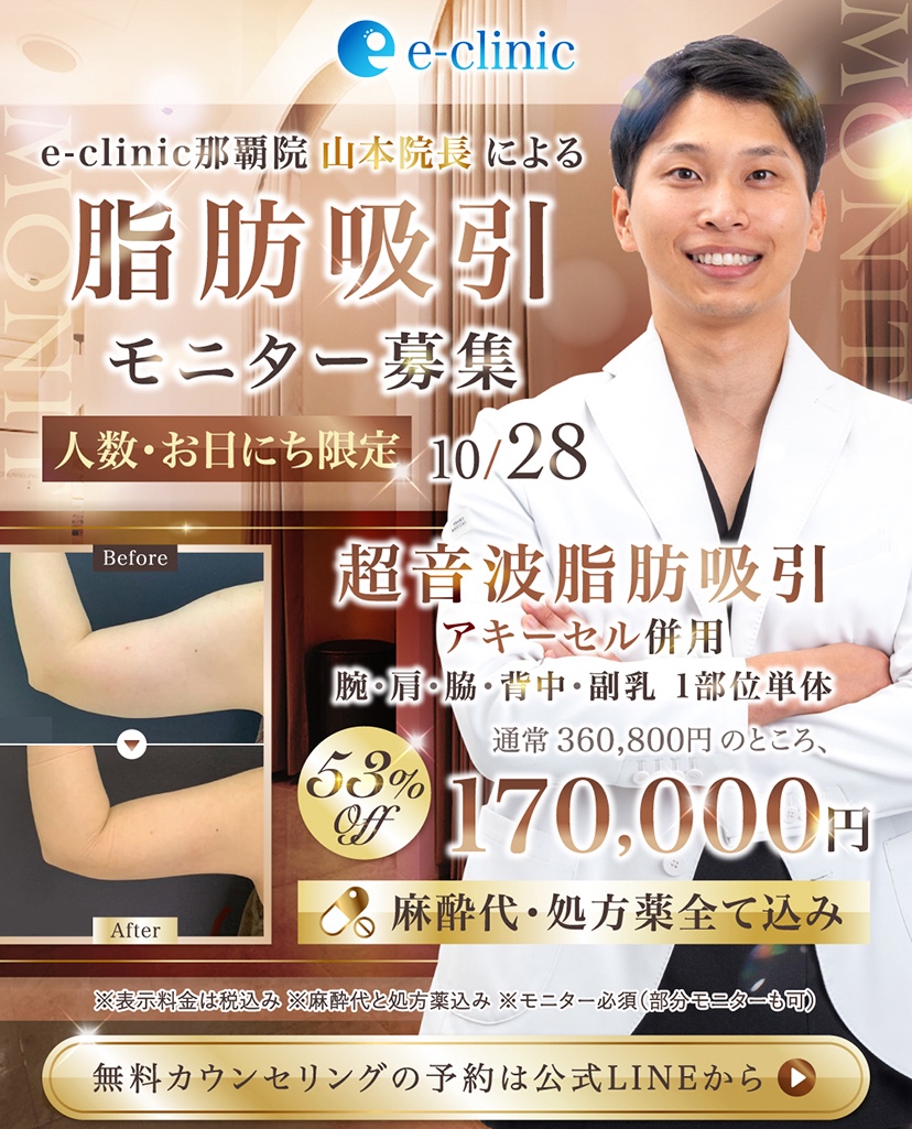 那覇院の脂肪吸引のキャンペーンバナー