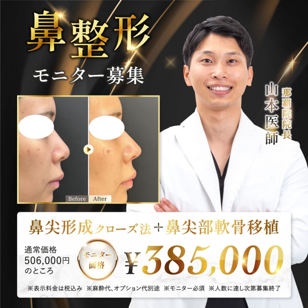 山本医師の鼻整形キャンペーンバナー