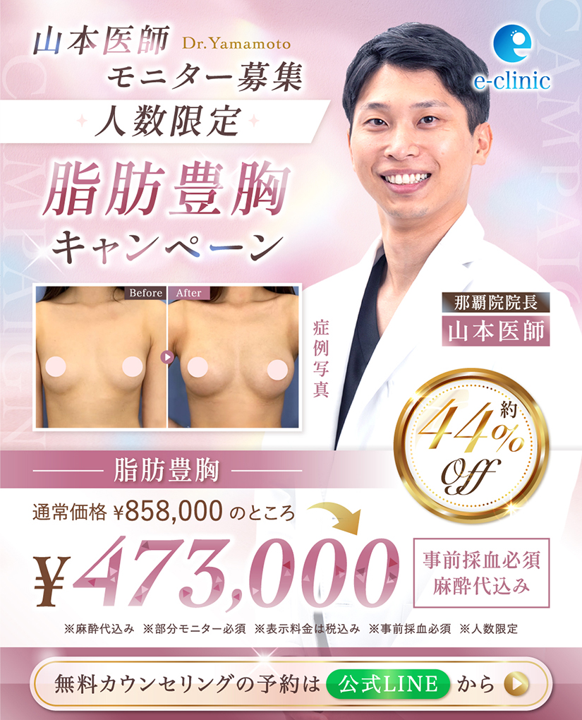 脂肪豊胸キャンペーンのバナー