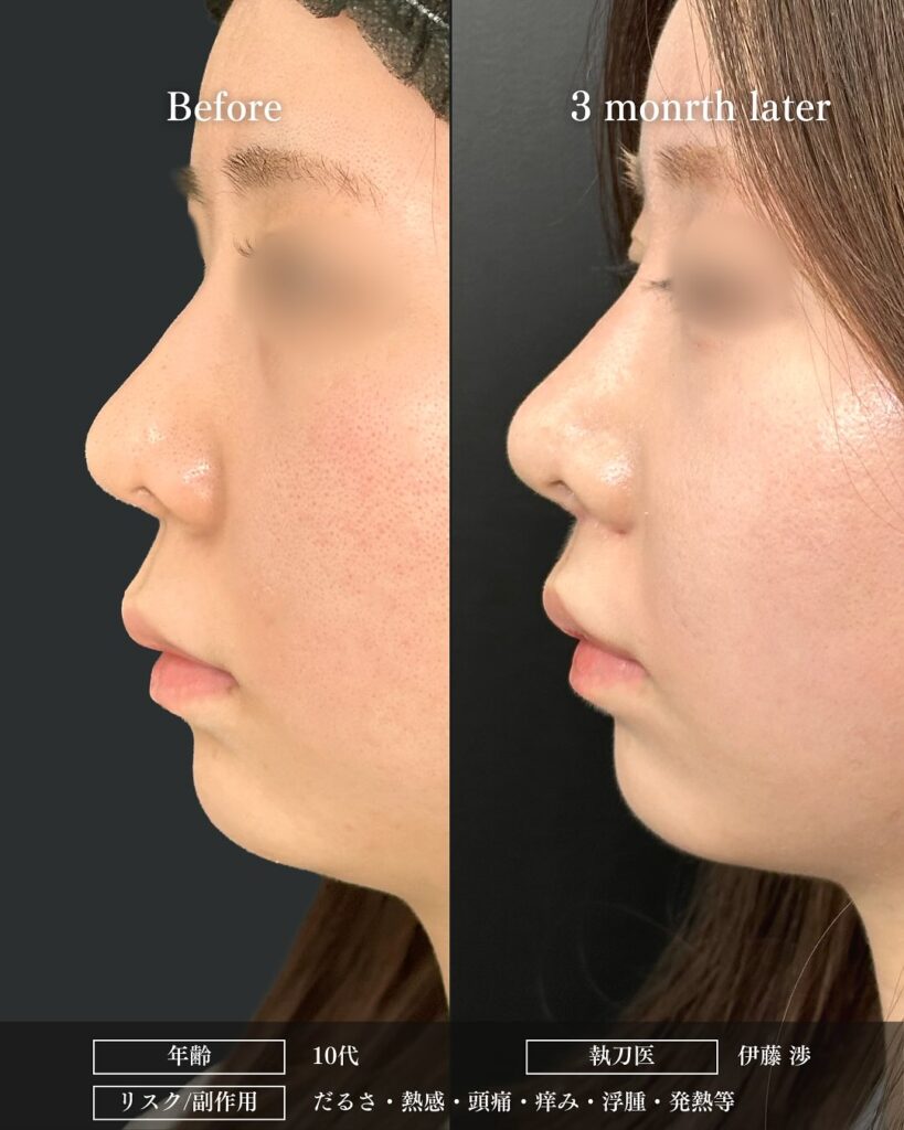 人中短縮の症例写真 (22)