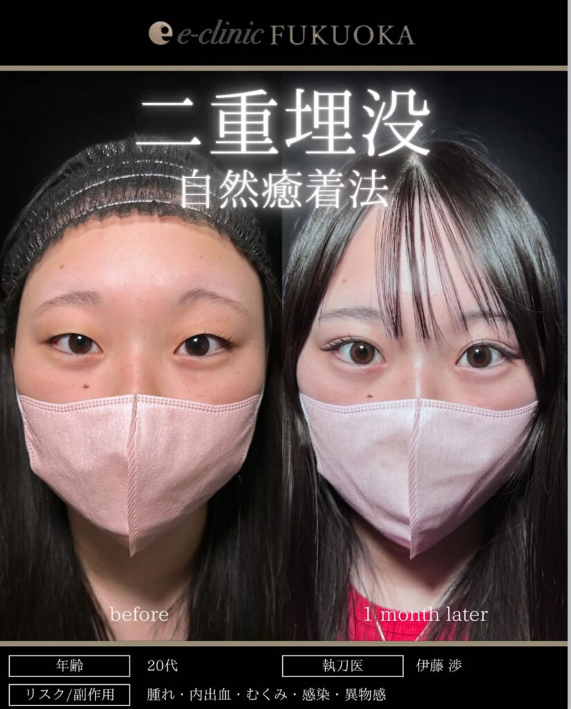 自然癒着法の症例写真1