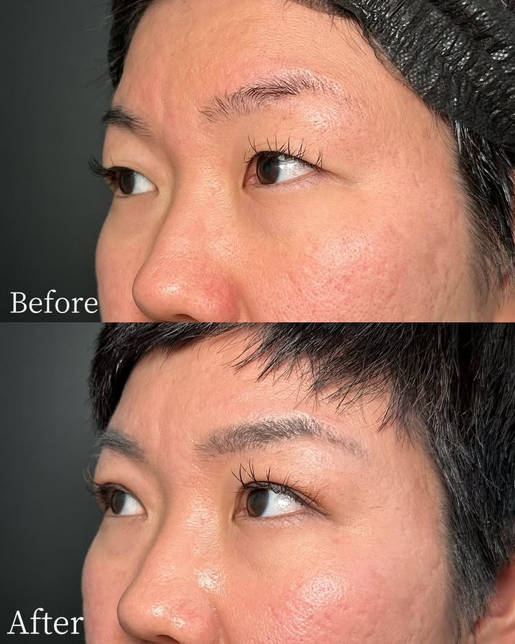 自然癒着法の症例写真 (18)