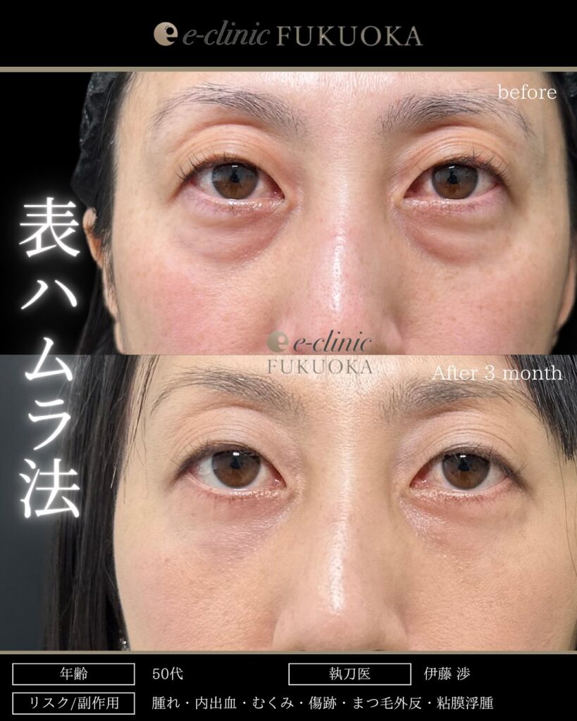 表ハムラの症例写真 (1)