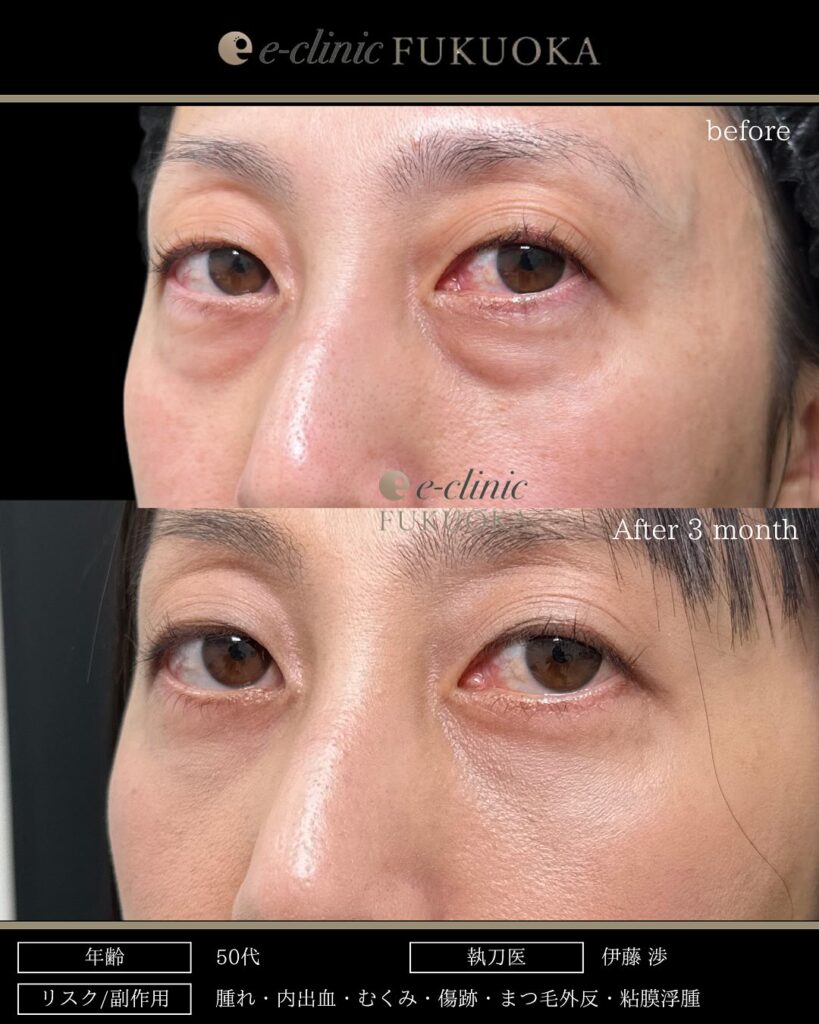 表ハムラの症例写真 (3)