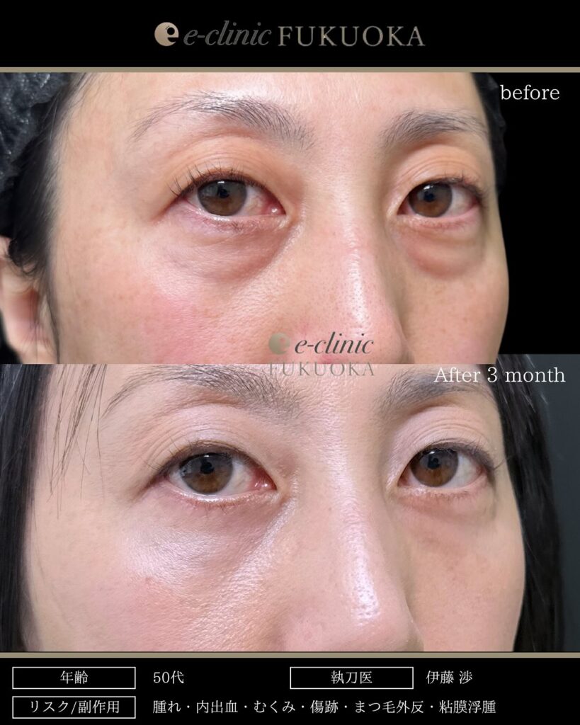 表ハムラの症例写真 (2)