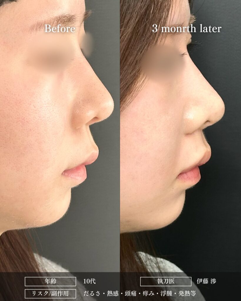 人中短縮の症例写真 (21)