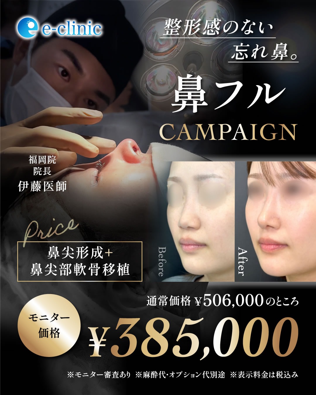 鼻フルのモニターバナー