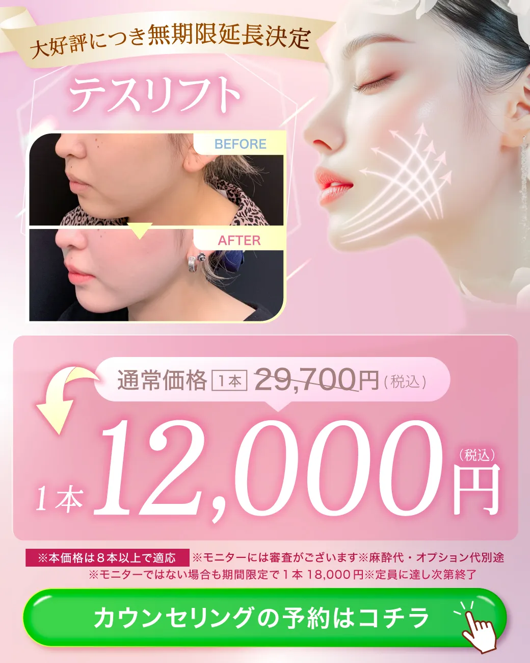 閑散期ヒアルロン酸CP