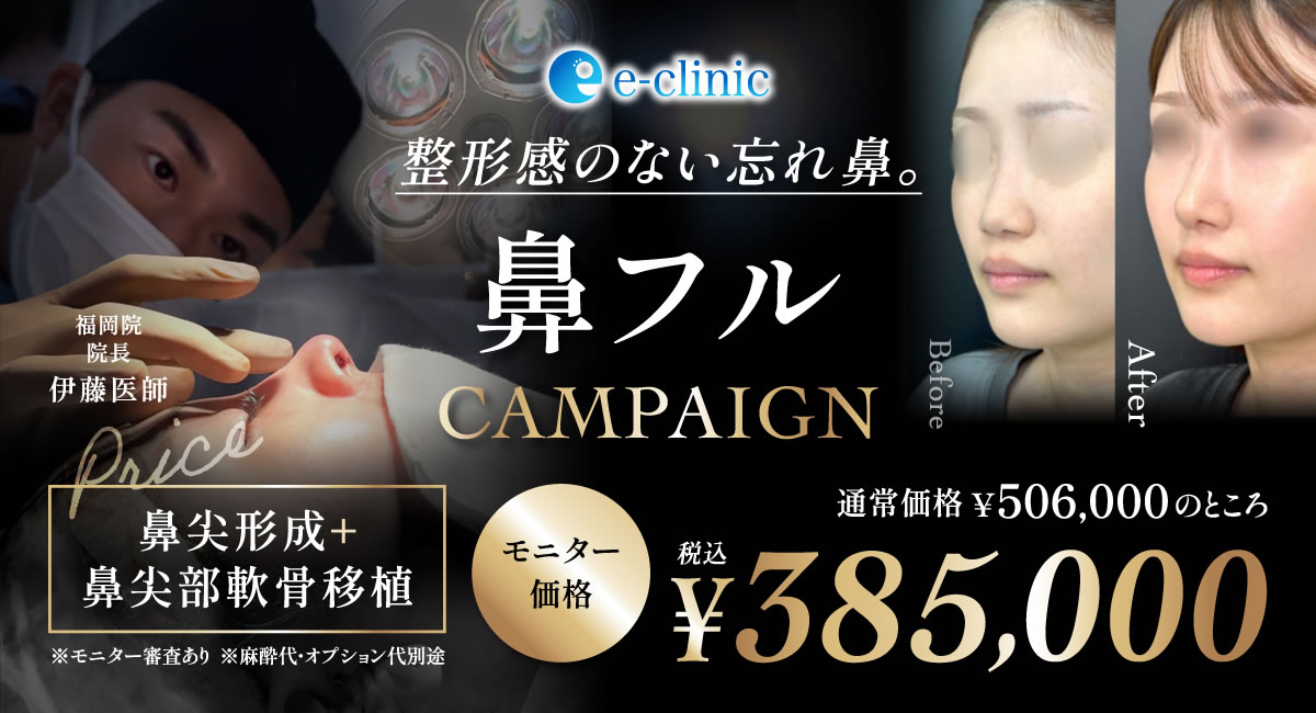 鼻フルのモニターバナー