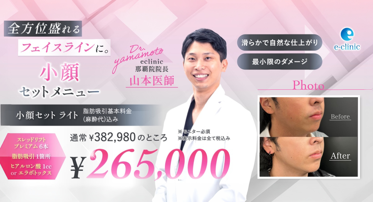 小顔セットメニューのバナー