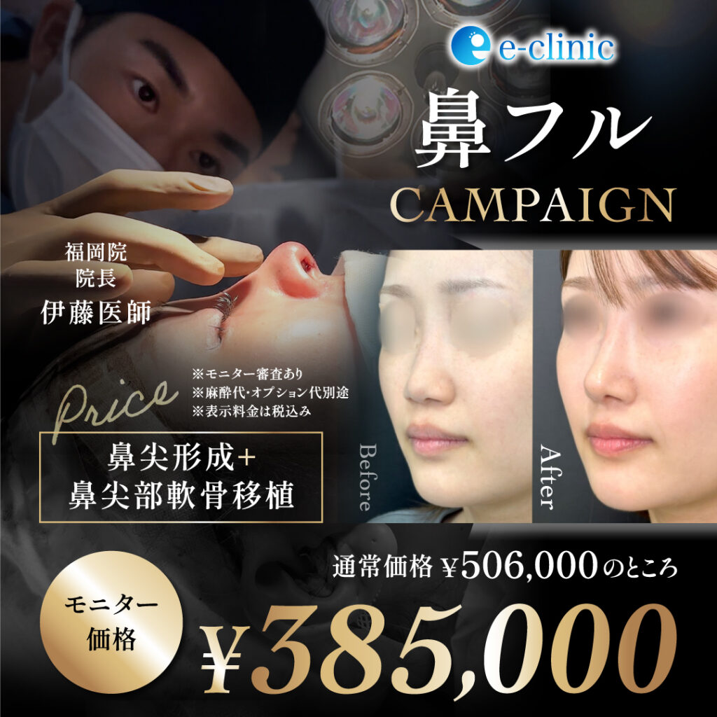 那覇の鼻フルのモニターバナー