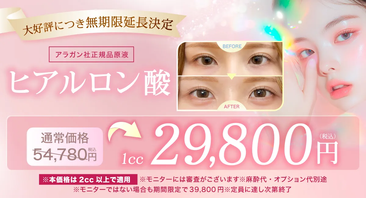 閑散期ヒアルロン酸CP