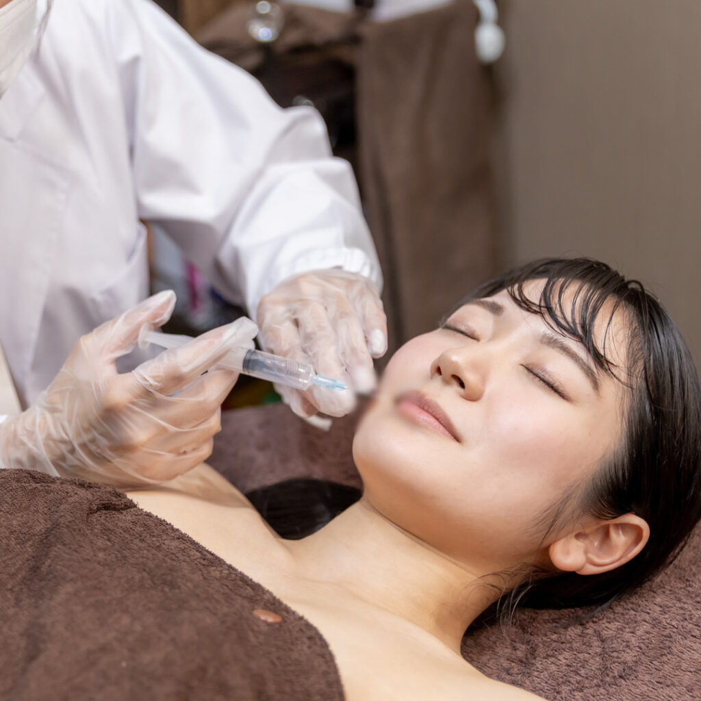 唇のヒアルロン酸注入のイメージ