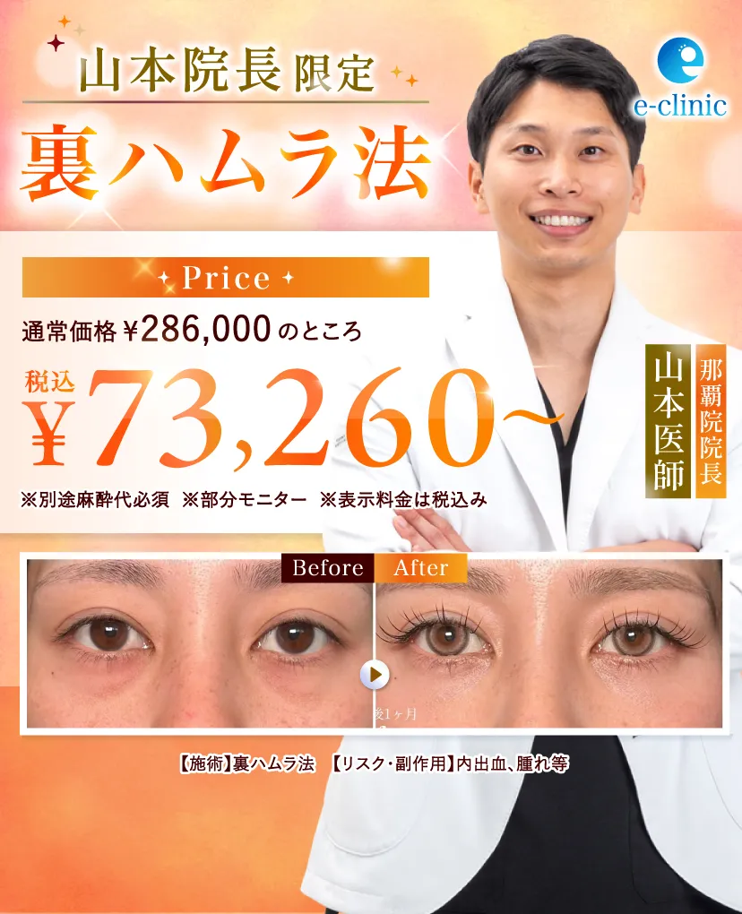 裏ハムラCP
