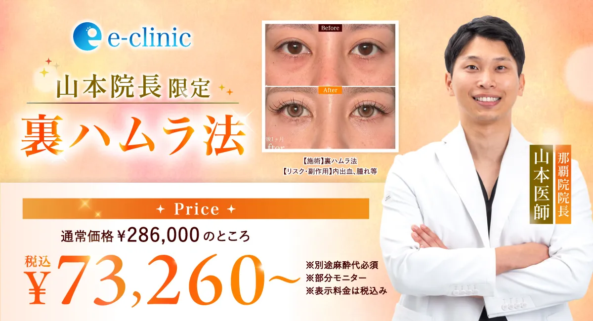 裏ハムラCP