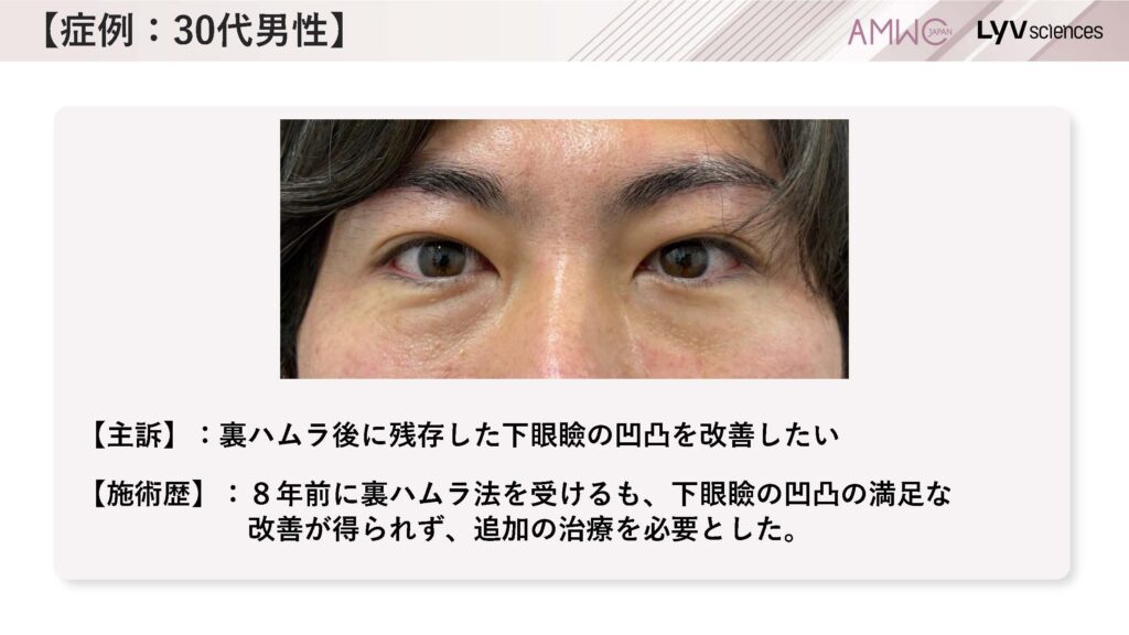 12_症例:30代男性