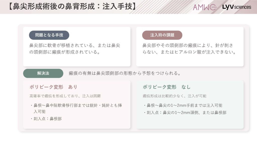 23_鼻尖形成術後の鼻背形成:注入手技