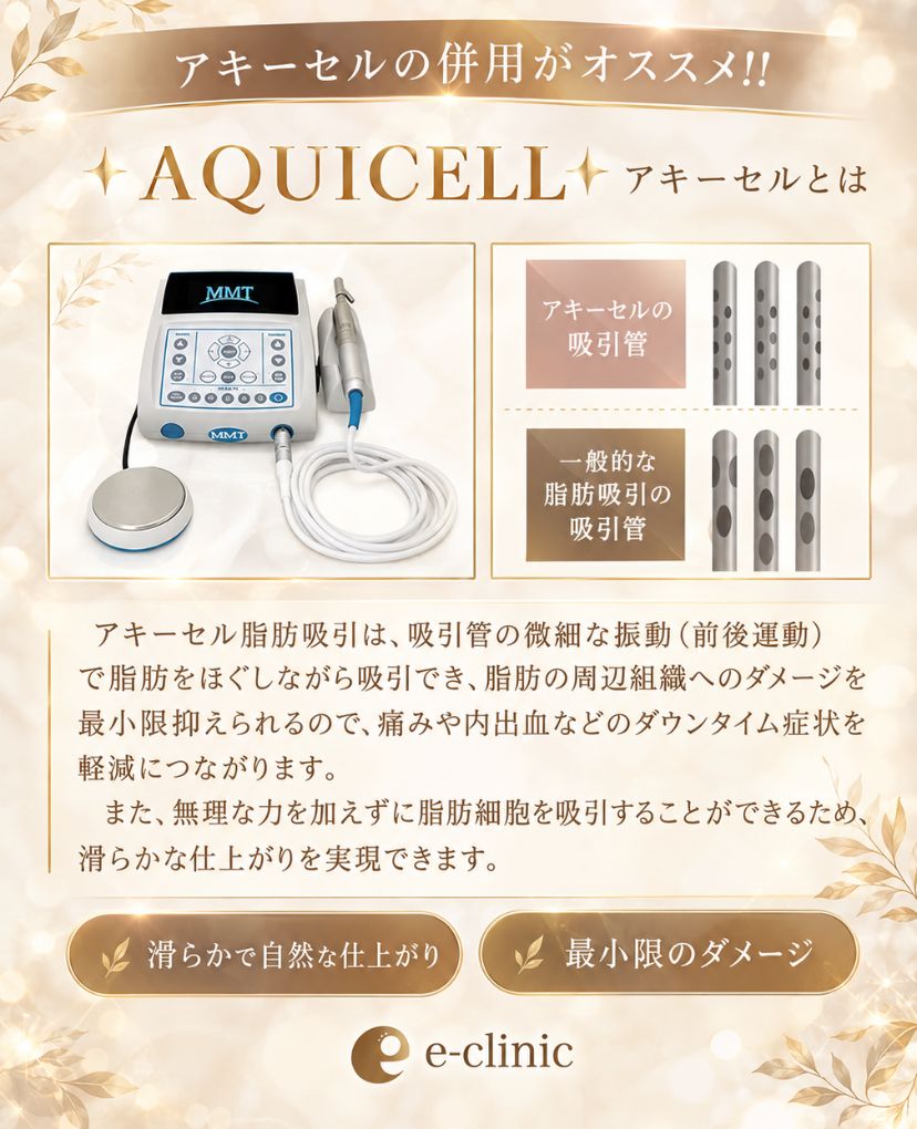 アキーセルの説明